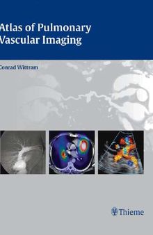 Atlas of Pulmonary Vascular Imaging (A Multimodality Approach)