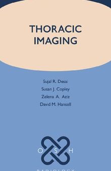 Thoracic Imaging (Oxford Specialist Handbooks in Radiology)