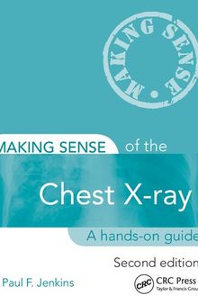 Making Sense of the Chest X-ray: A hands-on guide
