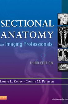 Sectional Anatomy for Imaging Professionals, 3e