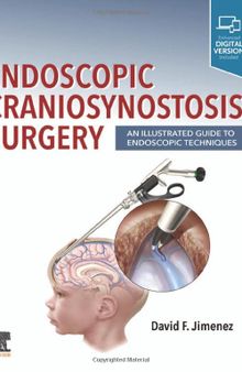 Endoscopic Craniosynostosis Surgery: An Illustrated Guide to Endoscopic Techniques