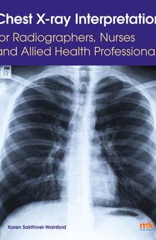 Chest X-ray Interpretation for Radiographers, Nurses and Allied Health Professionals