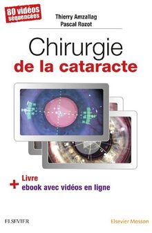 Chirurgie de la cataracte