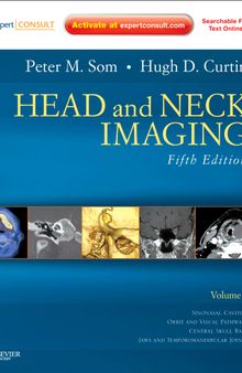 Head and Neck Imaging (Expert Consult)