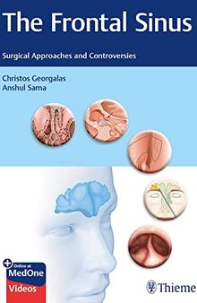 The Frontal Sinus: Surgical Approaches and Controversies
