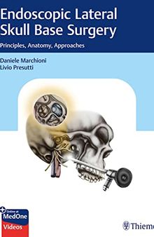 Endoscopic Lateral Skull Base Surgery: Principles, Anatomy, Approaches