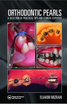 Orthodontic Pearls: A Selection of Practical Tips and Clinical Expertise