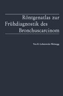 Röntgenatlas zur Frühdiagnostik des Bronchuscarcinom