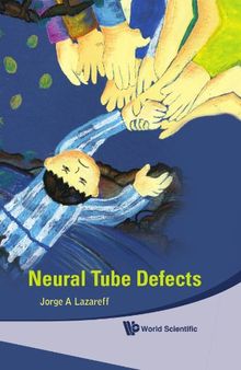 Neural Tube Defects