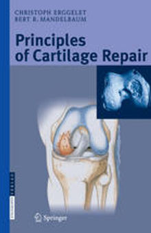 Principles of Cartilage Repair