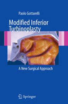 Modified Inferior Turbinoplasty: A New Surgical Approach