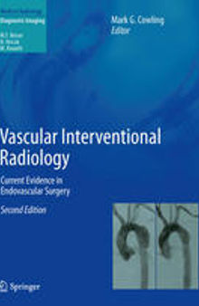 Vascular Interventional Radiology: Current Evidence in Endovascular Surgery