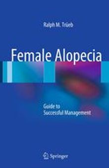 Female Alopecia: Guide to Successful Management