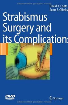 Strabismus Surgery and its Complications