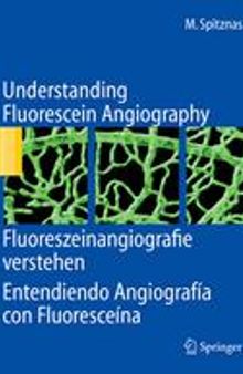 Understanding Fluorescein Angiography