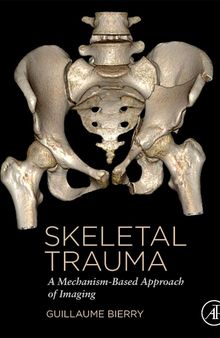 Skeletal Trauma: A Mechanism-Based Approach of Imaging