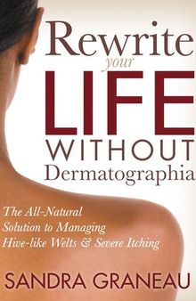 Rewrite Your Life Without Dermatographia: The All-Natural Solution to Managing Hive-like Welts and Severe Itching