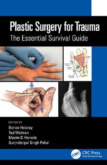 Plastic Surgery for Trauma: The Essential Survival Guide