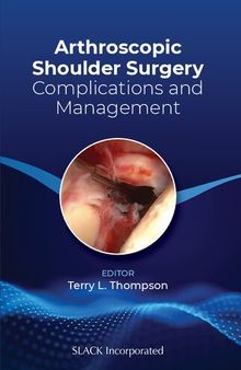 Arthroscopic Shoulder Surgery: Complications and Management