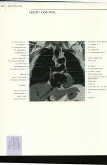 Mri Total Body Atlas: Orthopedics, Volume 2