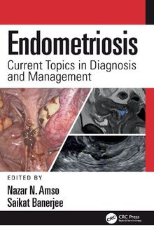 Endometriosis: Current Topics in Diagnosis and Management