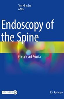 Endoscopy of the Spine: Principle and Practice