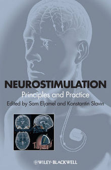 Neurostimulation: Principles and Practice