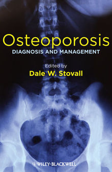 Osteoporosis: Diagnosis and Management