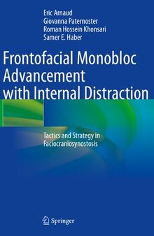 Frontofacial Monobloc Advancement with Internal Distraction: Tactics and Strategy in Faciocraniosynostosis