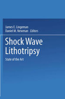 Shock Wave Lithotripsy: State of the Art