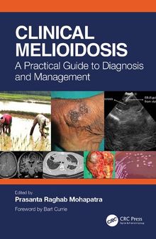 Clinical Melioidosis: A Practical Guide to Diagnosis and Management