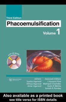 Phacoemulsification. / Volume I
