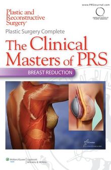 Plastic Surgery Complete: The Clinical Masters of PRS: Breast Reduction