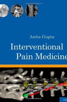Interventional pain medicine