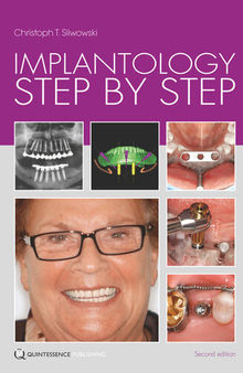 Implantology Step by Step