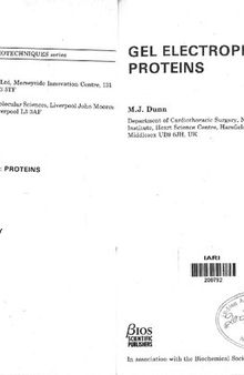 Gel Electrophoresis: Proteins