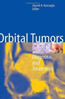 Orbital Tumors: Diagnosis and Treatment