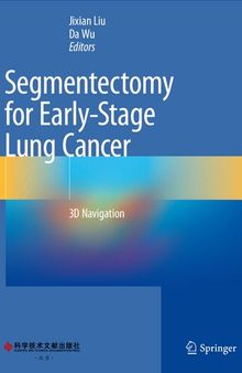 Segmentectomy for Early-Stage Lung Cancer: 3D Navigation