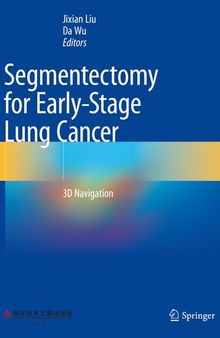 Segmentectomy for Early-Stage Lung Cancer: 3D Navigation