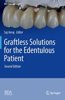 Graftless Solutions for the Edentulous Patient (BDJ Clinician’s Guides)
