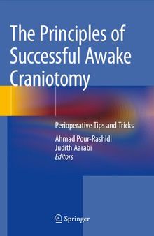 The Principles of Successful Awake Craniotomy: Perioperative Tips and Tricks