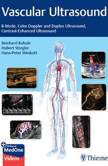 Vascular Ultrasound: B-Mode, Color Doppler and Duplex Ultrasound, Contrast-Enhanced Ultrasound [Team-IRA] (True PDF)