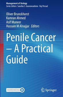 Penile Cancer – A Practical Guide (Management of Urology)