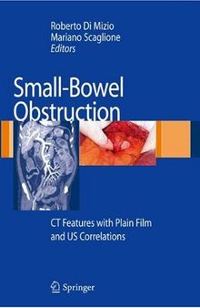 Small-Bowel Obstruction: CT Features with Plain Film and US correlations