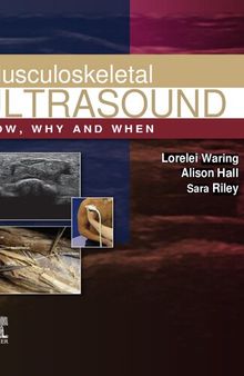 Musculoskeletal Ultrasound: How, Why and When