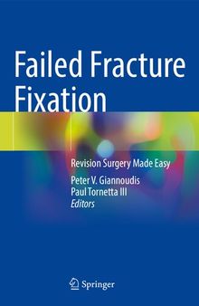 Failed Fracture Fixation: Revision Surgery Made Easy