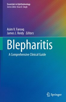 Blepharitis: A Comprehensive Clinical Guide