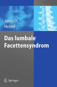 Das lumbale Facettensyndrom (German Edition)