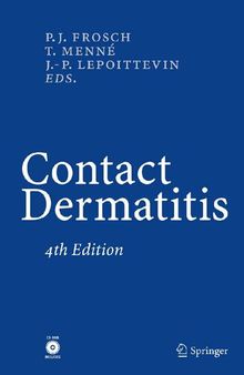 Textbook of Contact Dermatitis