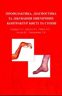 Профілактика, діагностика та лікування ішемічних контрактур кисті та стопи